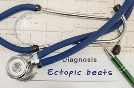 Diagnosing an ectopic heartbeat
